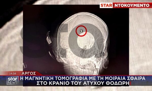 Άργος: Νέα σοκαριστικά ντοκουμέντα από την ιατρική γνωμάτευση του άτυχου 20χρονου