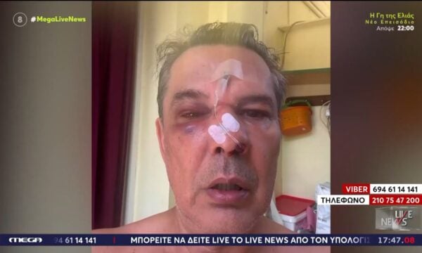 Χαϊδάρι: Επίθεση σε σοκ σε ιατρείο – Του ζήτησε να κάνει ησυχία και τον χτύπησε άγρια