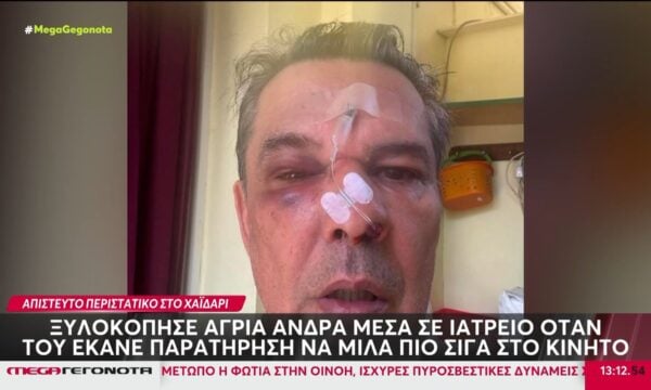 Χαϊδάρι: Ξυλοκόπησε άγρια άνδρα μέσα σε ιατρείο επειδή του έκανε παρατήρηση για το κινητό