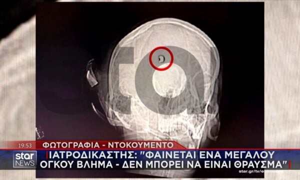 Ιατροδικαστής: «Φαίνεται να είναι μεγάλου όγκου βλήμα – Δε μπορεί να είναι θραύσμα»