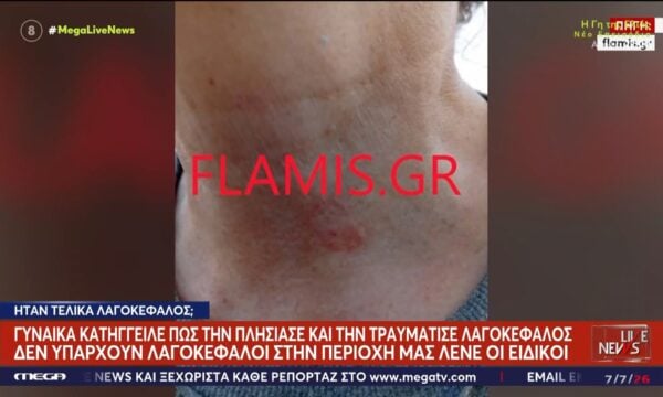 Πάτρα: Γυναίκα κατήγγειλε πως την πλησίασε και την τραυμάτισε λαγοκέφαλος