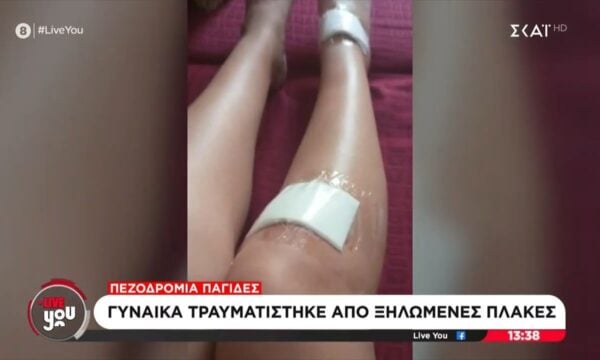 Πεζοδρόμια – παγίδες: Γυναίκα τραυματίστηκε από ξηλωμένες πλάκες