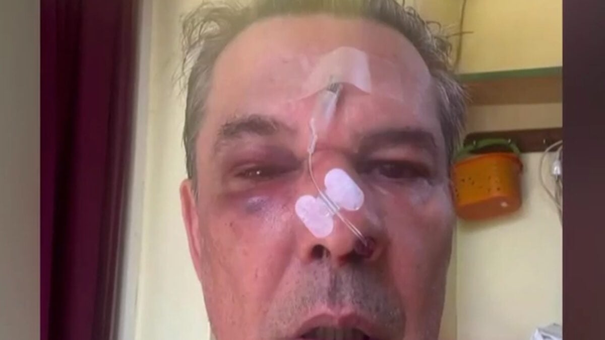 Χαϊδάρι: Άνδρας δέχτηκε επίθεση σε ιατρείο επειδή είπε σε άλλον να μιλά πιο χαμηλόφωνα στο κινητό 1 Χαϊδάρι: Άνδρας δέχτηκε επίθεση σε ιατρείο επειδή είπε σε άλλον να μιλά πιο χαμηλόφωνα στο κινητό