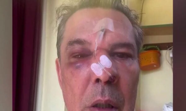 Χαϊδάρι: Άνδρας δέχτηκε επίθεση σε ιατρείο επειδή είπε σε άλλον να μιλά πιο χαμηλόφωνα στο κινητό