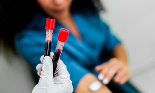 Αιμοδοσία: Ελλείψεις αίματος λόγω διακοπών και του ιού του Δυτικού Νείλου