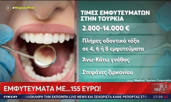 Δελεάζουν με τιμές από 150€ για εμφυτεύματα δοντιών οι Τούρκοι – Αστραφτερά χαμόγελα μετατρέπονται σε… μασέλα