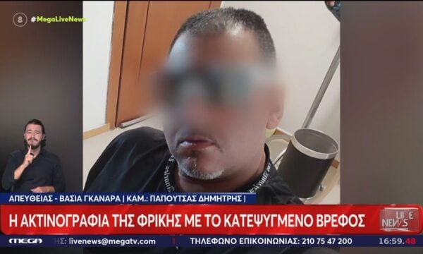 Φρίκη στην Κυψέλη:  Σε αντιφάσεις πέφτει η 38χρονη – Με τατουάζ στο πρόσωπο ο 43χρονος