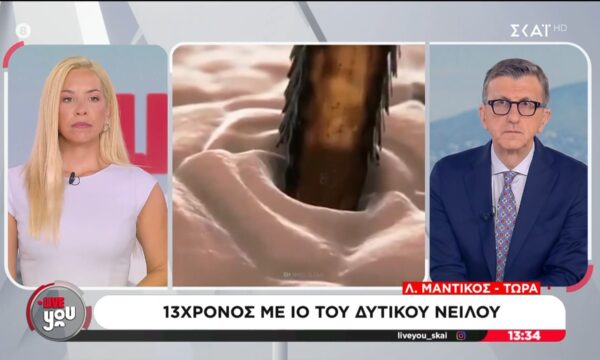 Ιός Δυτικού Νείλου: 13χρονος νοσηλεύεται με βαριά συμπτώματα