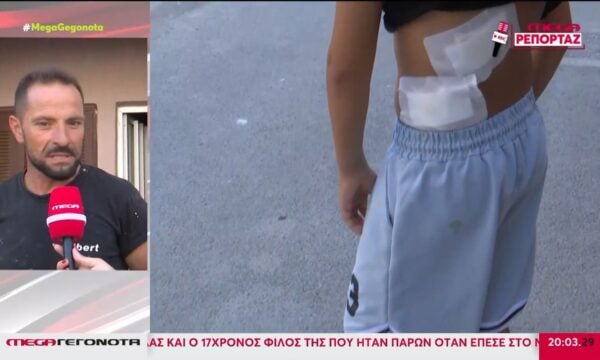 Κρήτη: Στο νοσοκομείο 12χρονος μετά από επίθεση πίτμπουλ – Συνελήφθη 28χρονη