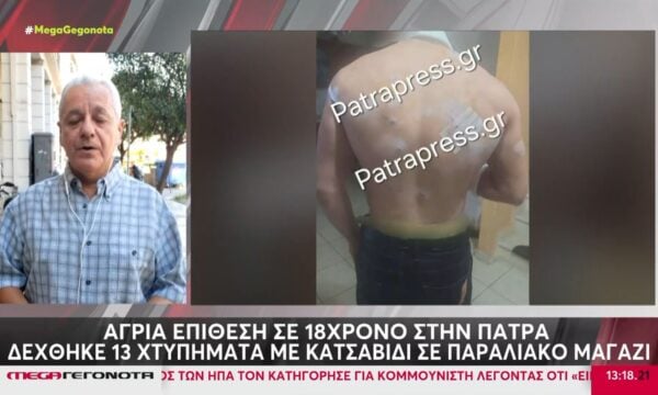 Πάτρα: Άγρια επίθεση με κατσαβίδι σε βάρος 18χρονου – Δέχτηκε 13 χτυπήματα από πολυμελή ομάδα ατόμων