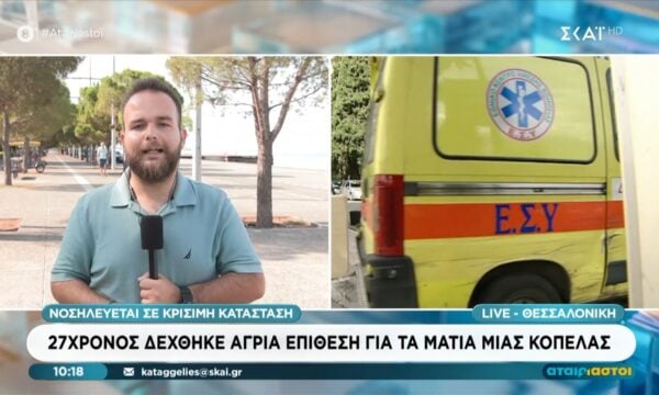 Θεσσαλονίκη | 27χρονος δέχθηκε επίθεση για τα μάτια μιας κοπέλας