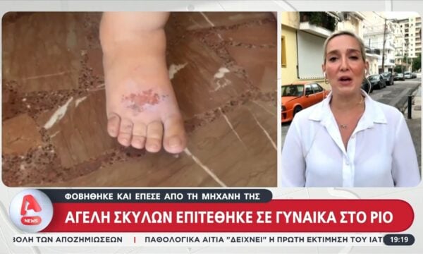 Τρομακτικές στιγμές για 54χρονη στο Ρίο: Δέχτηκε επίθεση από αγέλη σκύλων έξω από νοσοκομείο