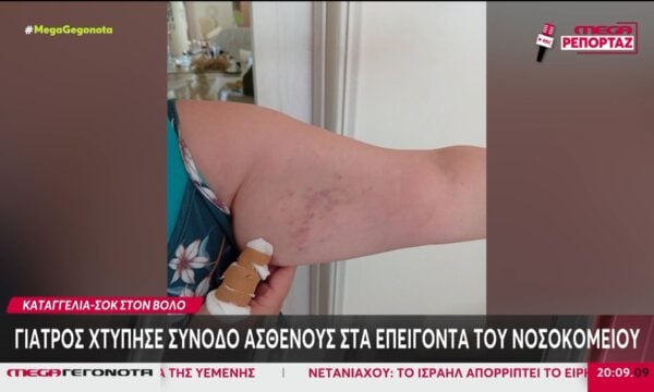 Βόλος: Γιατρός χτύπησε συνοδό ασθενούς στα Επείγοντα του νοσοκομείου