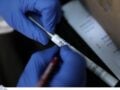 Medwatch: Εντόπισε μπότοξ και υαλουρονικό σε οδοντιατρεία, επιχειρήσεις χωρίς βεβαίωση λειτουργίας – Ο απολογισμός του πρώτου 10ημέρου