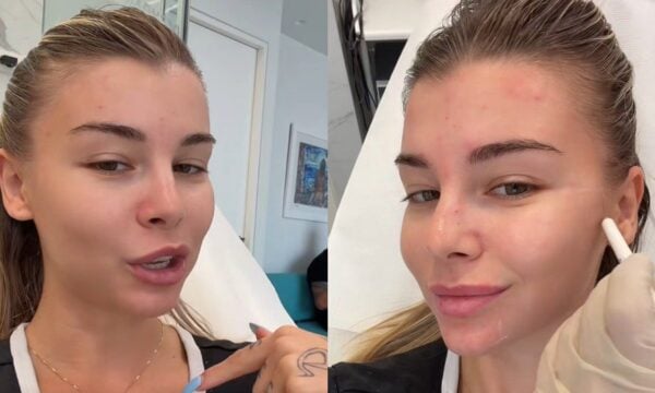 Modern Cinderella: Έκανε Botox στην κάμερα και έδειξε τον σύντροφό της – Τι απαντά σε όσους λένε ότι είναι μικρή