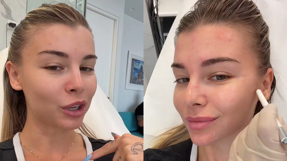 Modern Cinderella: Έκανε Botox στην κάμερα και έδειξε τον σύντροφό της – Τι απαντά σε όσους λένε ότι είναι μικρή 2 Modern Cinderella: Έκανε Botox στην κάμερα και έδειξε τον σύντροφό της – Τι απαντά σε όσους λένε ότι είναι μικρή