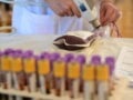 «Συνθήκες Άγριας Δύσης στην αναγεννητική ιατρική», καταγγέλλει γιατρός με αφορμή τον θάνατο του Γιώργου Μαζωνάκη