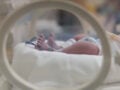 Πάτρα: Θλίψη για νεογέννητο κοριτσάκι που πέθανε λίγο μετά τη γέννησή του