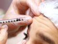 Έφηβοι και μπότοξ: Ακόμη και 14χρονα ζητούν θεραπείες και 16χρονα διόρθωση υαλουρονικού – Οι προειδοποιήσεις των ειδικών