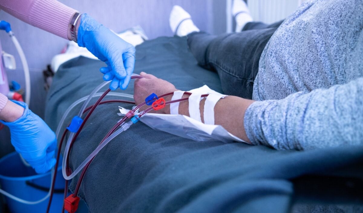 Πλασμαφαίρεση: Το νομικό κενό στην αγορά και χρήση μηχανημάτων – «Σαν να αγοράζεις αυτοκίνητο χωρίς δίπλωμα»