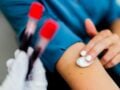 Πλασμαφαίρεση: Γιατί δεν είναι «αναγεννητική ιατρική» και σε ποιες περιπτώσεις γίνεται στην Ελλάδα