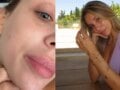 Γαρυφαλλιά Καληφώνη: Η πάθηση που την ταλαιπωρεί – «Αν έρθω μπροστά στην κάμερα θα τρομάξετε…»