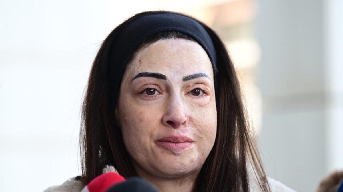 Ιωάννα Παλιοσπύρου: Σοκ για πιθανή αποφυλάκιση της γυναίκας που της έριξε βιτριόλι – Τη χαρακτηρίζει εγκληματία 1 Ιωάννα Παλιοσπύρου: Σοκ για πιθανή αποφυλάκιση της γυναίκας που της έριξε βιτριόλι – Τη χαρακτηρίζει εγκληματία