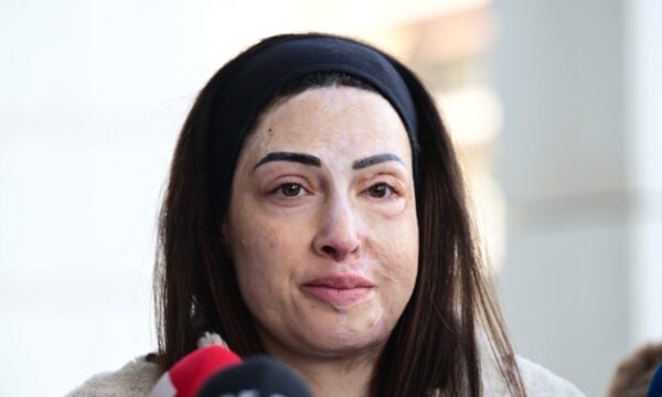Ιωάννα Παλιοσπύρου: Σοκ για πιθανή αποφυλάκιση της γυναίκας που της έριξε βιτριόλι – Τη χαρακτηρίζει εγκληματία