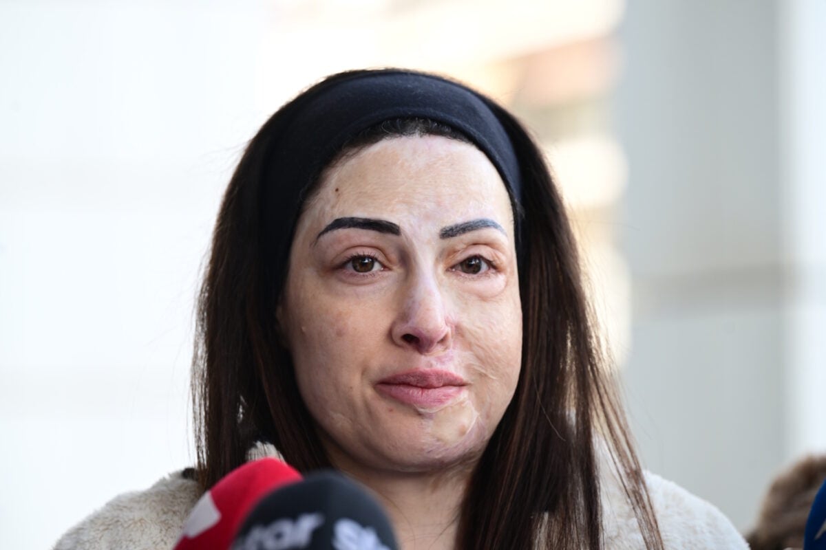 Ιωάννα Παλιοσπύρου: Σοκ για πιθανή αποφυλάκιση της γυναίκας που της έριξε βιτριόλι – Τη χαρακτηρίζει εγκληματία