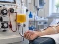 Θεραπευτική πλασμαφαίρεση: Τι είναι, σε ποια νοσήματα εφαρμόζεται, η διαδικασία και οι παρενέργειες