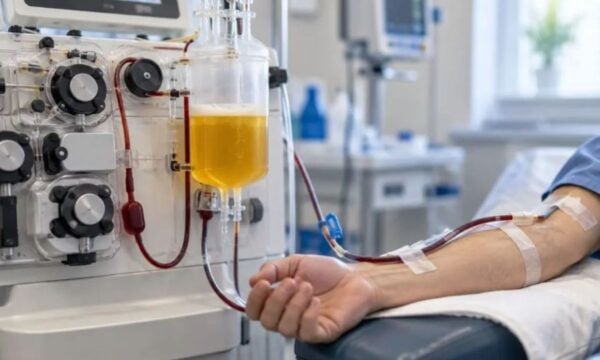 Θεραπευτική πλασμαφαίρεση: Τι είναι, σε ποια νοσήματα εφαρμόζεται, η διαδικασία και οι παρενέργειες