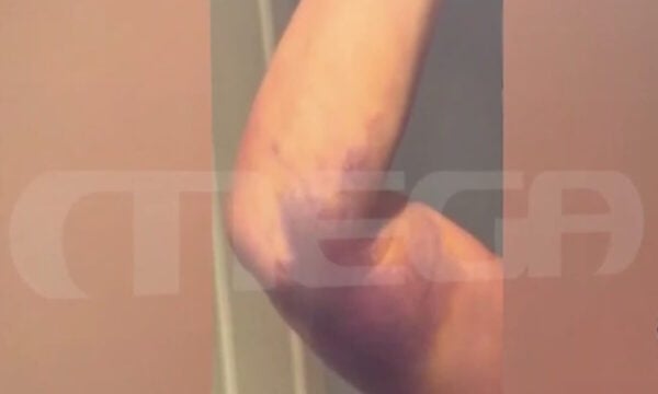 Γιώργος Μαζωνάκης: Βίντεο με τη γιατρό σε πλασμαφαίρεση άλλης ασθενούς – «Μπρος στα κάλλη τι είναι ο πόνος;»