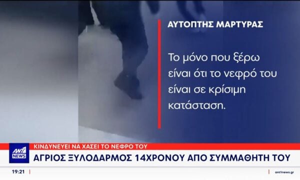 Άγριος ξυλοδαρμός 14χρονου από συμμαθητή του – Μαρτυρίες στον ΑΝΤ1