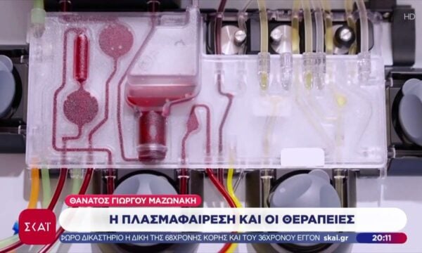 Αιματολόγοι μιλούν για την πλασμαφαίρεση που τα τελευταία χρόνια έχει γίνει… μόδα στους κύκλους των σταρ