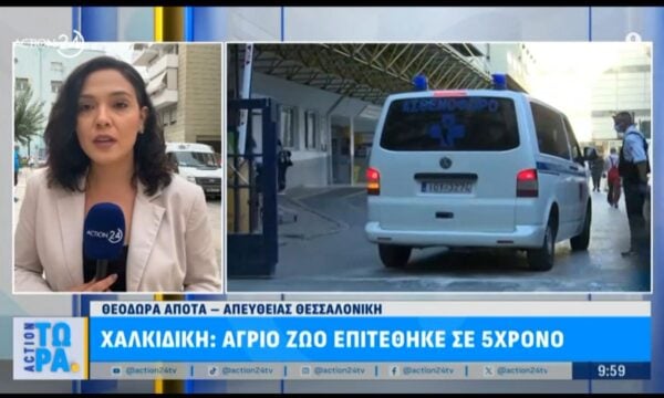 Χαλκιδική: Άγριο ζώο επιτέθηκε σε 5χρονο