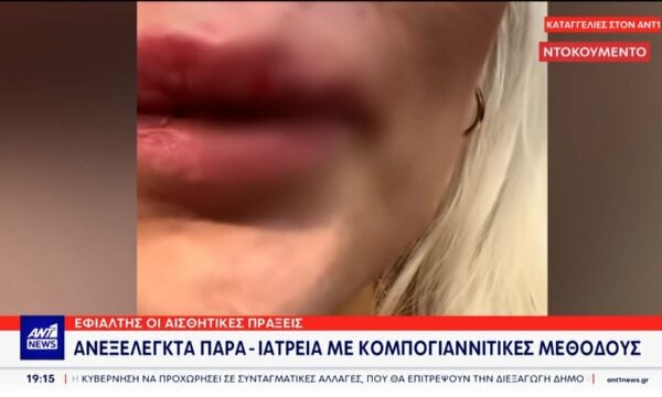 Παράνομες αισθητικές πράξεις: Ανεξέλεγκτα ιατρεία με ‘κομπογιαννίτικες’ μεθόδους