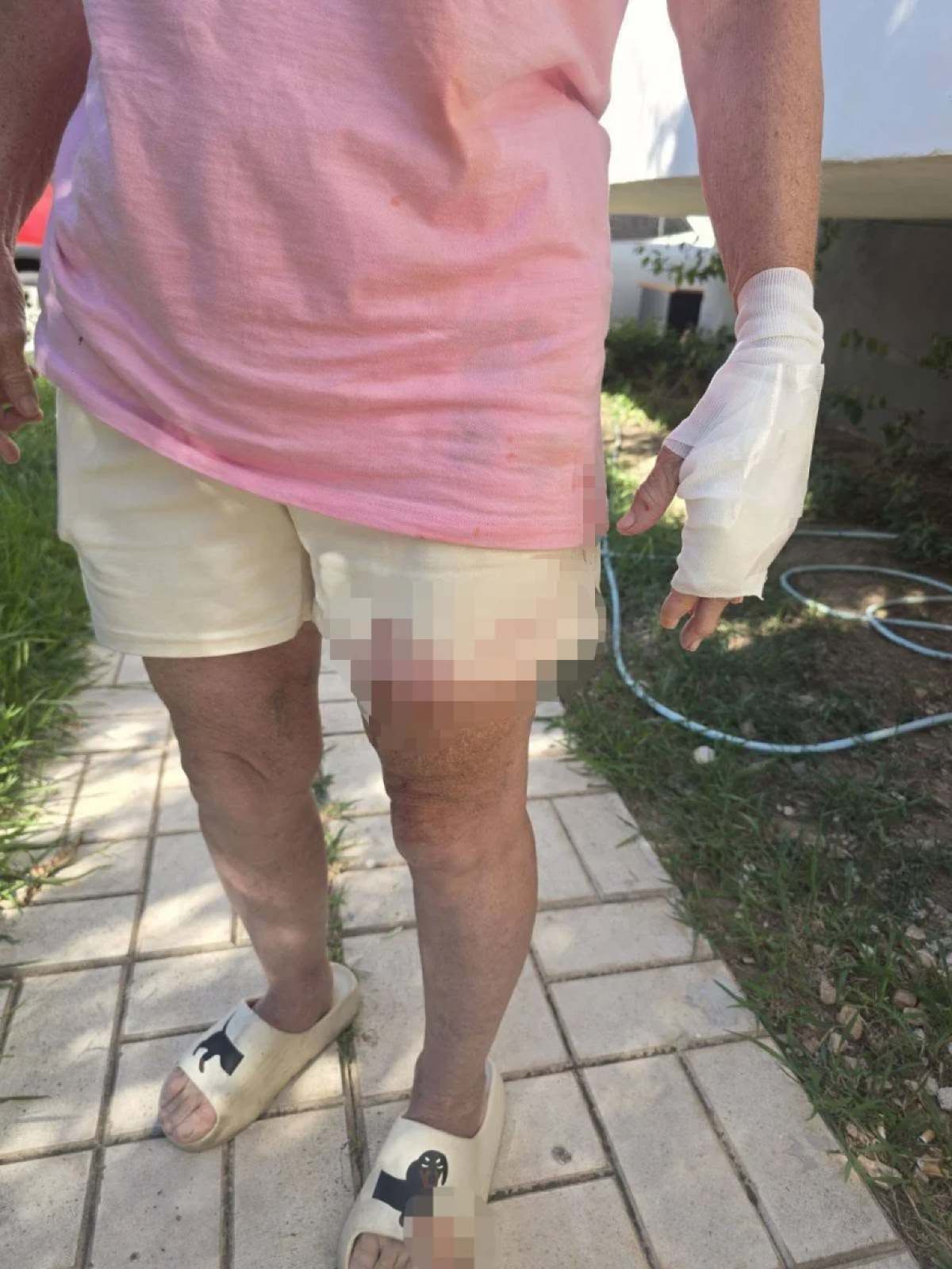Θύμα επίθεσης σκύλων