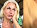 Χριστίνα Κοντοβά για την περιπέτεια υγείας της στην Ουγκάντα: «Ήμουν σε πολύ επικίνδυνο στάδιο»
