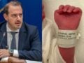 Γιώργος Κώτσηρας: Στο νοσοκομείο από τη Βουλή ο 42χρονος – Έγινε πατέρας πριν από τρεις εβδομάδες